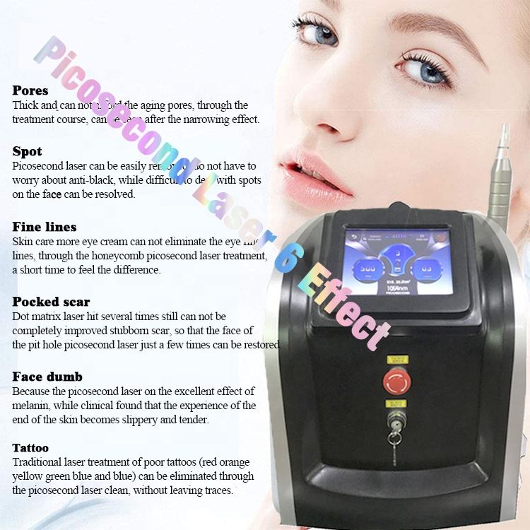 Salon laser tattoo removal machine scars remove Qswitch nd yag lazer picosecond lasers device picolaser beauty equipment