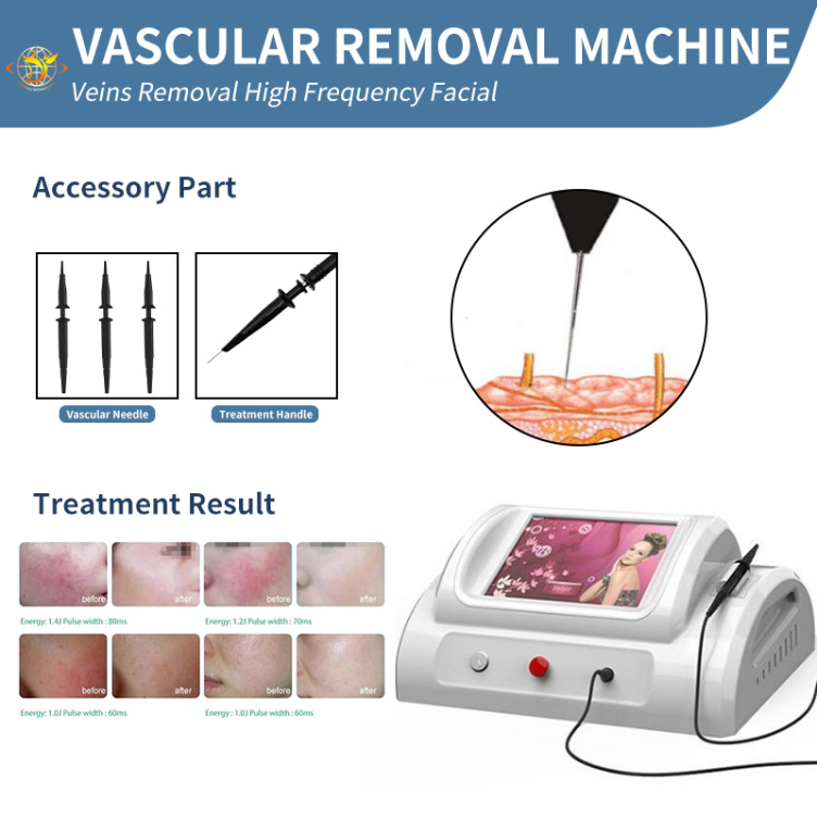 Laser Machine Diode Laser 980Nm Vein Removal Vascular Facial Spider Veins Red Blood
Laser Machine Diode Laser 980Nm Vein Removal Vascular Facial Spider Veins Red Blood