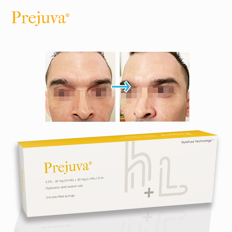 Prejuva Manufacturer Profhilo Filler Prices Beauty Items Facial Rejuvenation Bio-Remodelling Dermal Filler For Men Women
Prejuva Manufacturer Profhilo Filler Prices Beauty Items Facial Rejuvenation Bio-Remodelling Dermal Filler For Men Women