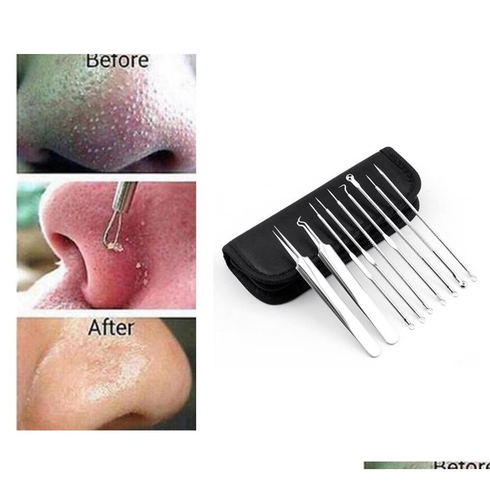 Cleaning Tools Accessories Sier Stainless Blackhead Comedone Acne Blemish Extractor Remover Pimple Pin Cosmetic Health Beauty Care Dhu6K
Cleaning Tools Accessories Sier Stainless Blackhead Comedone Acne Blemish Extractor Remover Pimple Pin Cosmetic Health Beauty Care Dhu6K