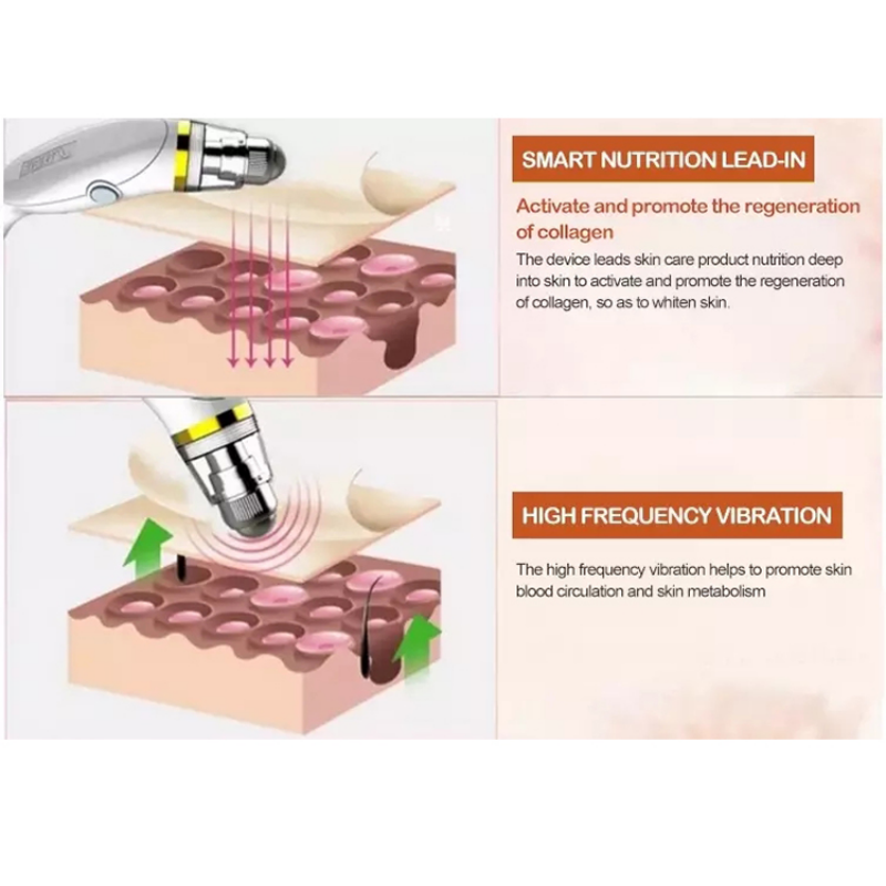 Other Beauty Equipment Eye Care Massager Eye Care Machine Eye Bag Dark Circle Removal..335