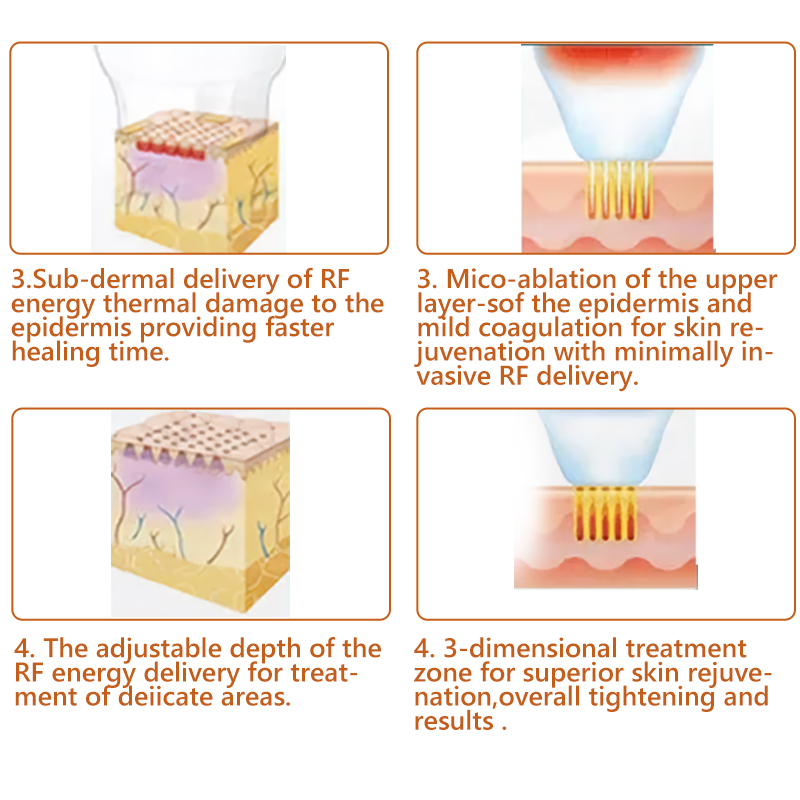 microneedle rf anti aging micro needle machine dark scar treatment SPA use device