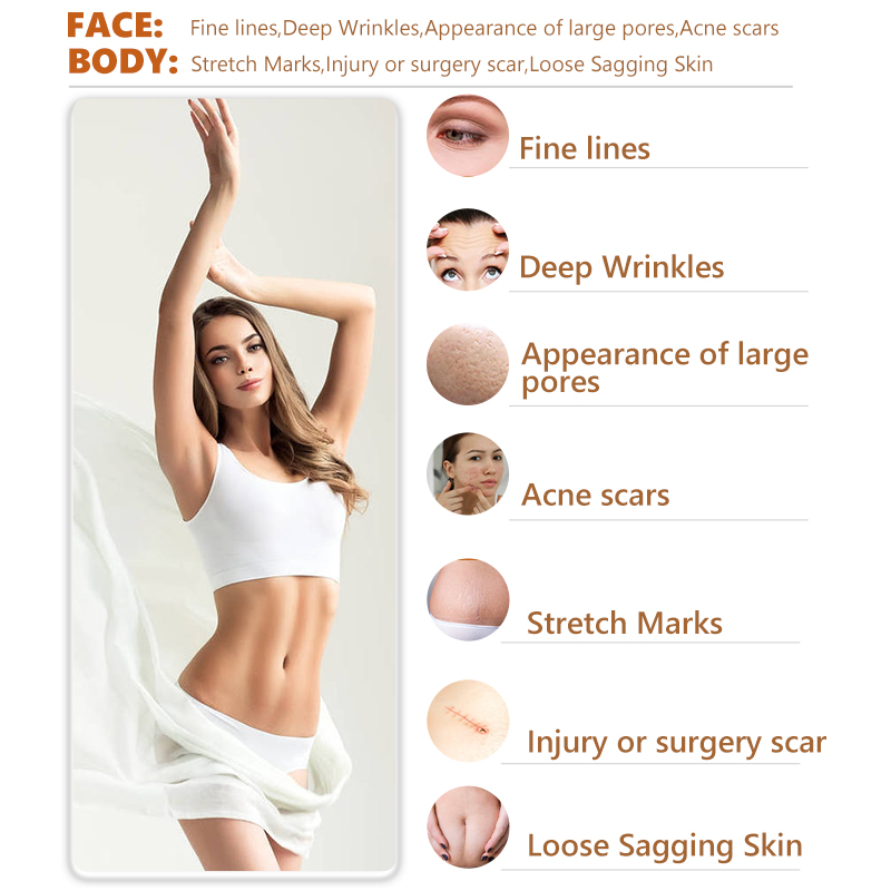 microneedle rf anti aging micro needle machine dark scar treatment SPA use device