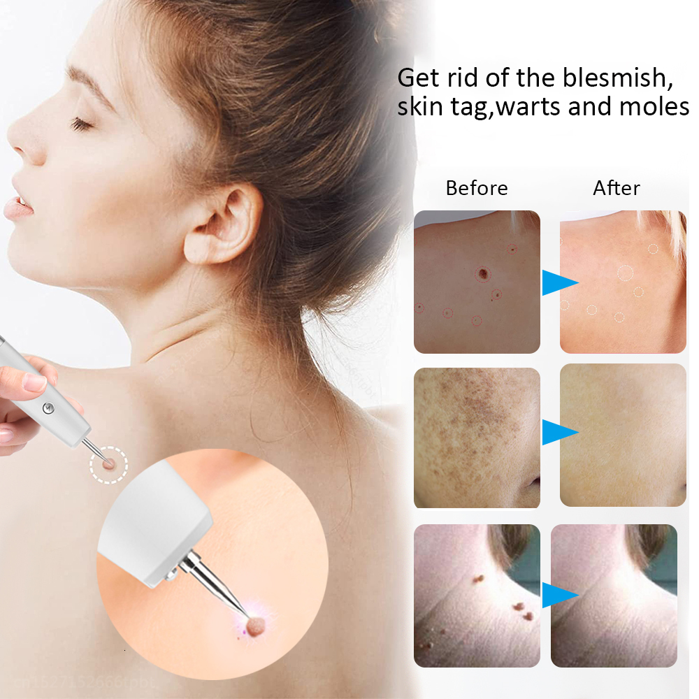 Face Care Devices Skin Tag Mole Remover for Dark Spots Laser Plasma Pen Electric Blemish Wart lcd Freckle Eliminator Black Dots Removal 221122