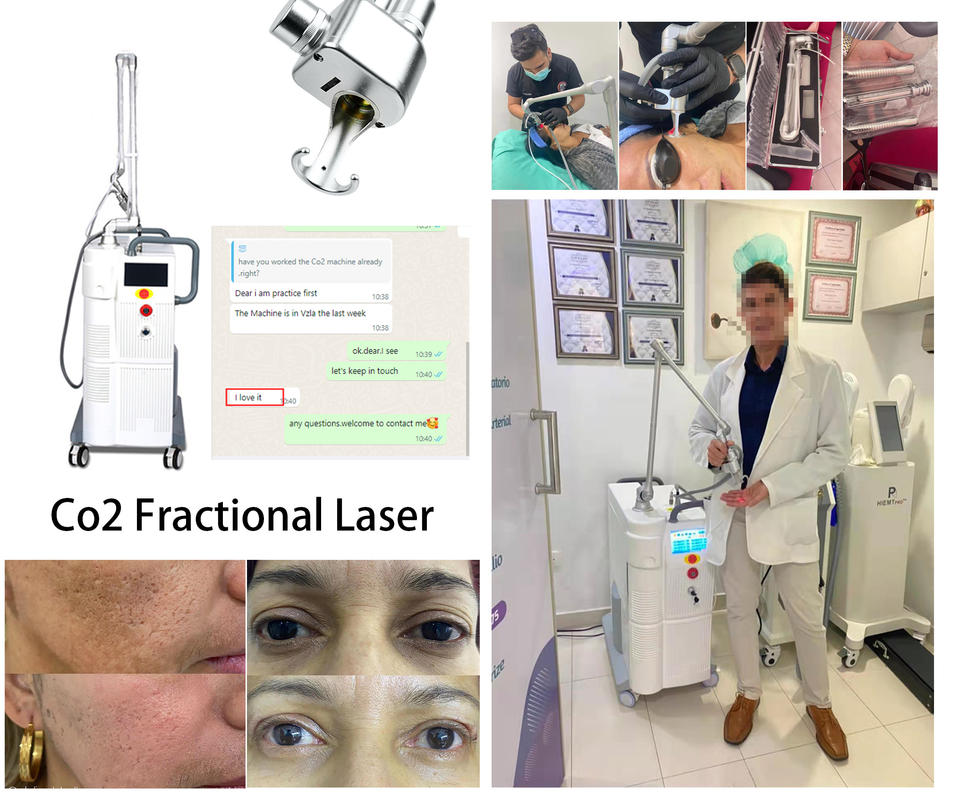 Laser Vertical 1060 nm wavelength for vaginal Stretch Marks removal Face Lift skin rejuvenation Safety Equipment