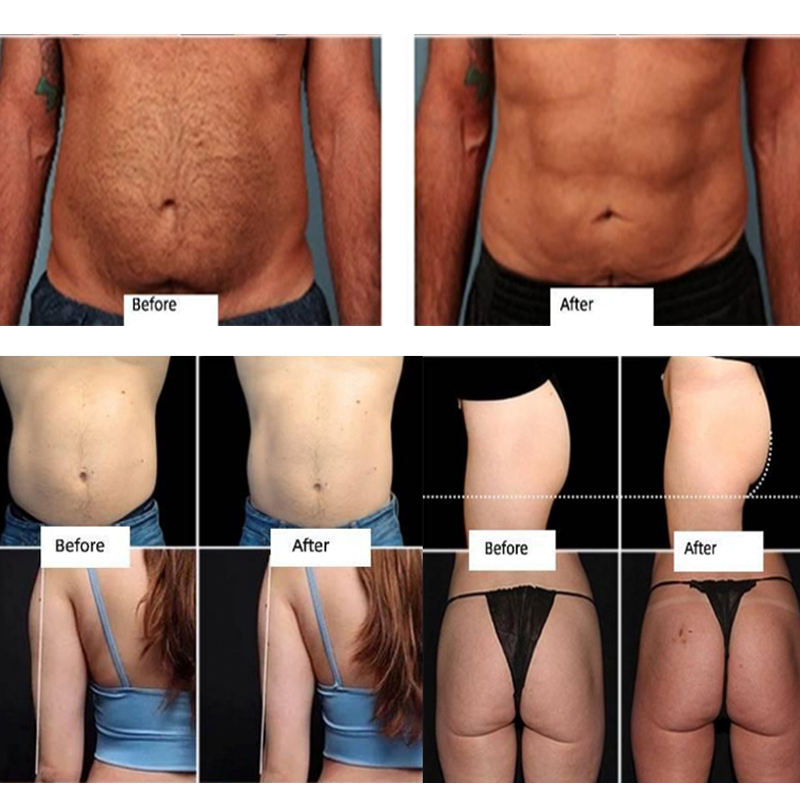 HI EMS EMT Slim Body Sculpting Muscle Stimulation Fat Burning Body Slimming Machine For Fitness