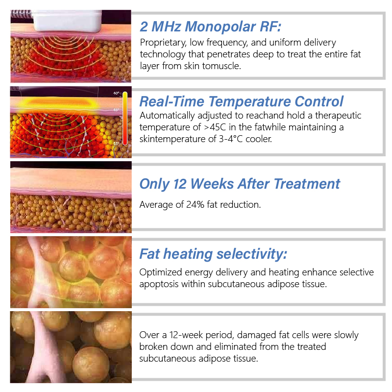 2023 Vertical Trusculpt Slimming Machine 1mhz Monopolar Fat Dissolving RF Radio Frequency Trushape Id Body SlimmingMachine With 8 Handles Loss Weight