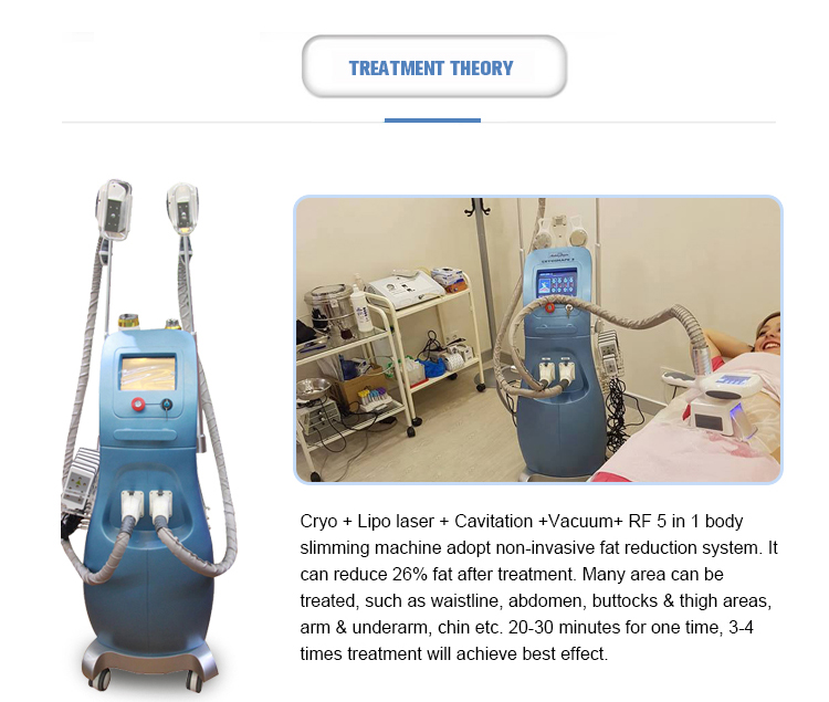 2022 NEW Weight Loss Beauty Equipment Fat Cryolipolysis Slimming Machine / Criolipolisis Machine Cryolipolysis