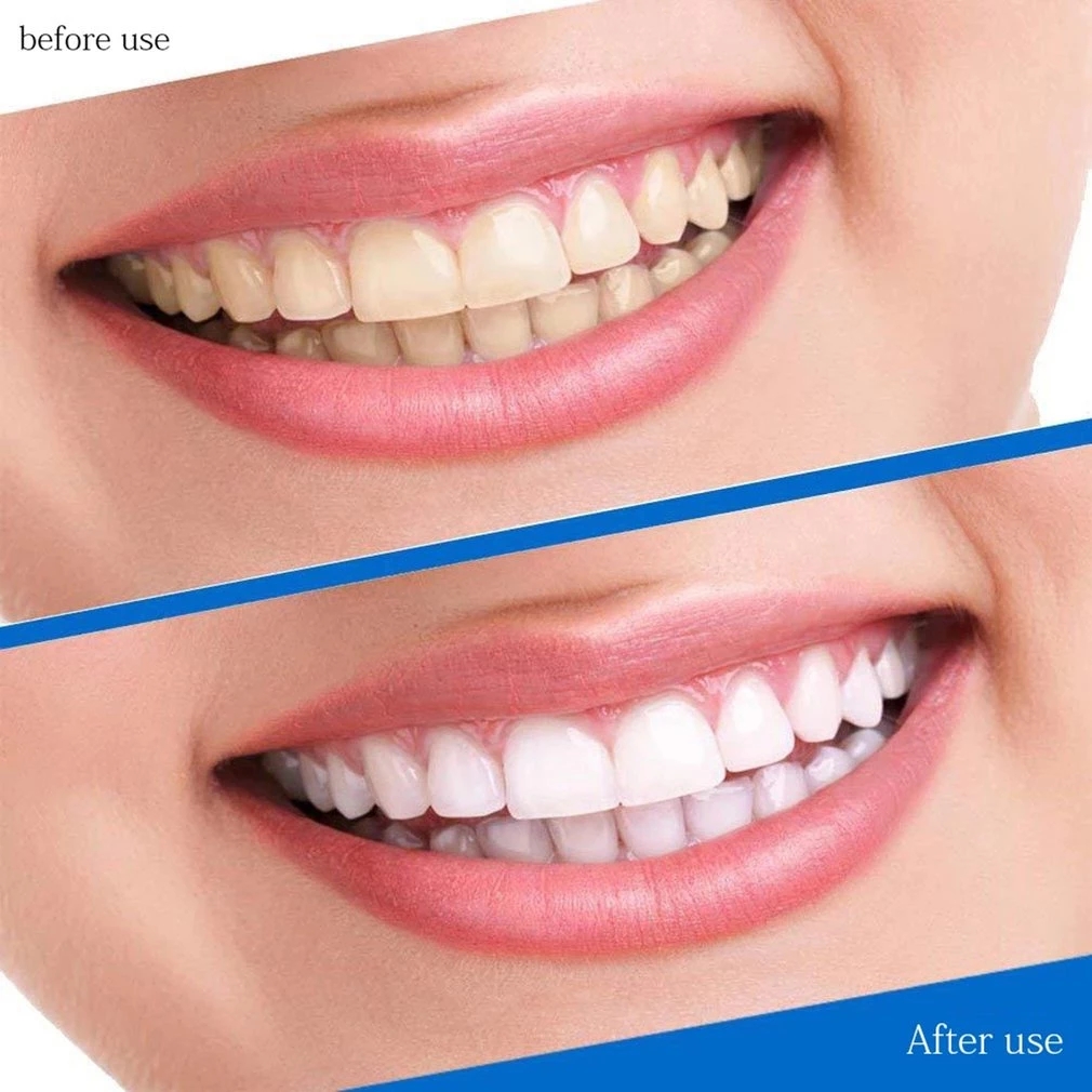 Teeth Whitening Strips 14 Pouches 28 Strip Oral Hygiene For Stains Removal X251022