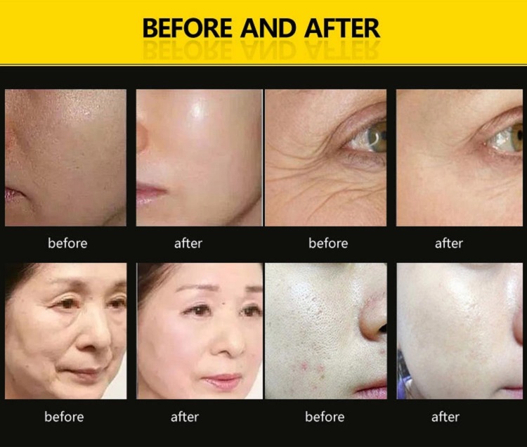 PDT BIO led 7 colors skin caring led photon beauty infrared light therapy machine