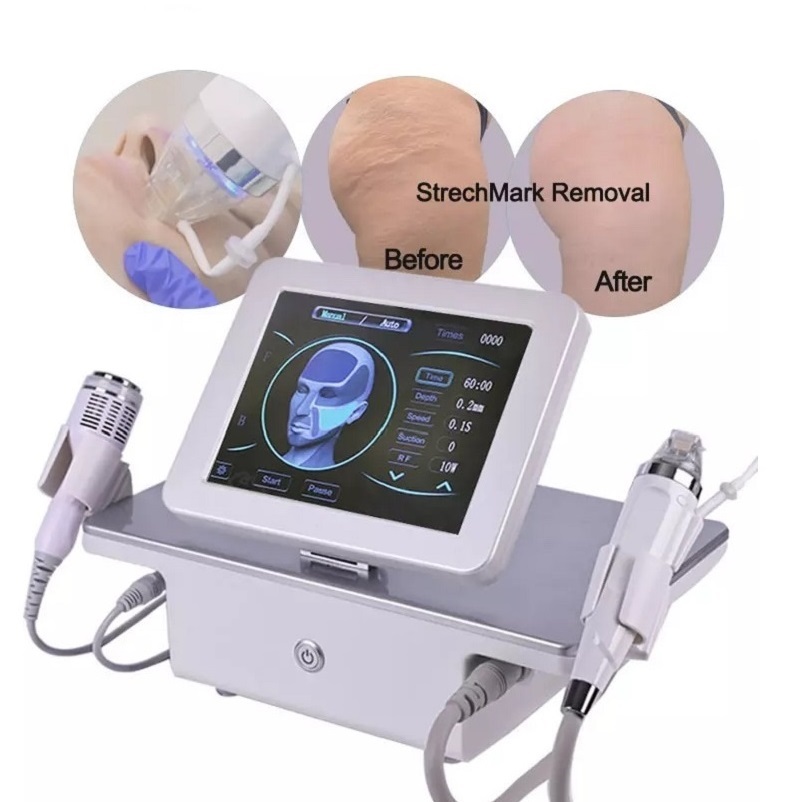 2-in-1 Microneedling RF Machine with Fractional Cold Hammer for Skin Tightening, Effective Acne Scar & Stretch Mark Removal, Professional Beauty Devic