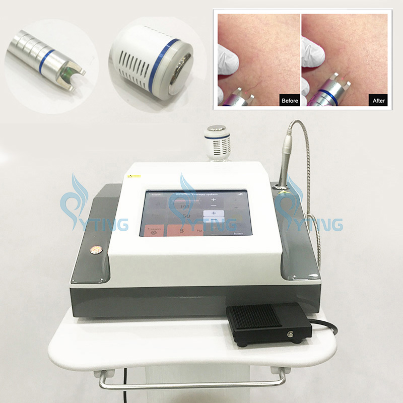 980nm Diode Laser Vascular Spider Vein Removal Blood Vessels Remove Spa Salon Use Vascular Remover Machine Beauty Equipment
980nm Diode Laser Vascular Spider Vein Removal Blood Vessels Remove Spa Salon Use Vascular Remover Machine Beauty Equipment