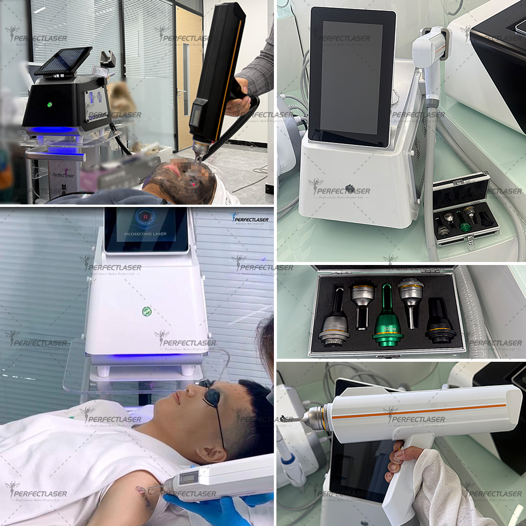 CE ISO Certified Portable Picosecond Laser Machine for Laser Tattoo Removal and Skin Care carbon peel laser machine