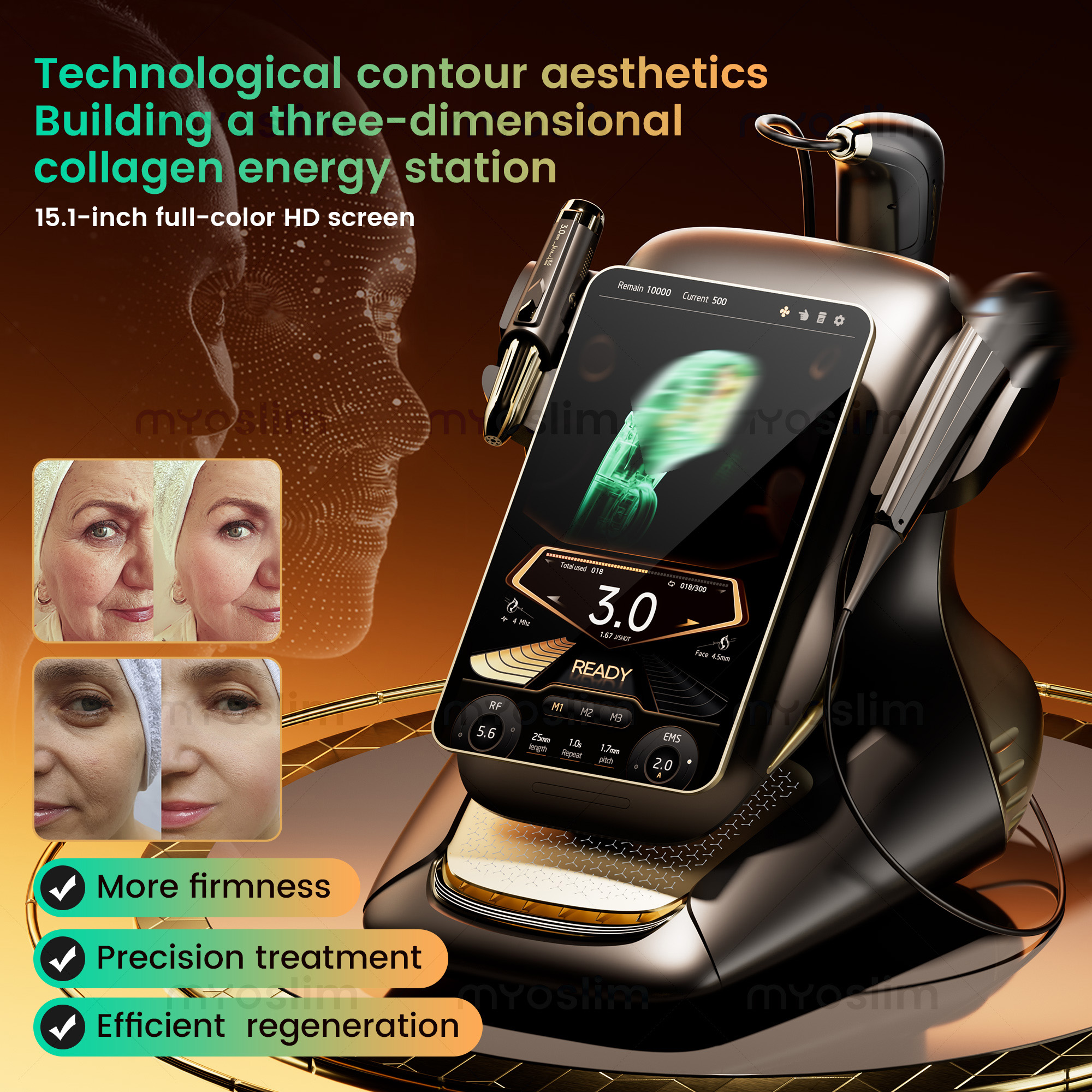 High Intensity 360MAX 25D Hifu+RF+EMS Home Use Hifu Beauty Machine Focused Ultrasound Skin Firming Face Lifting Hifu