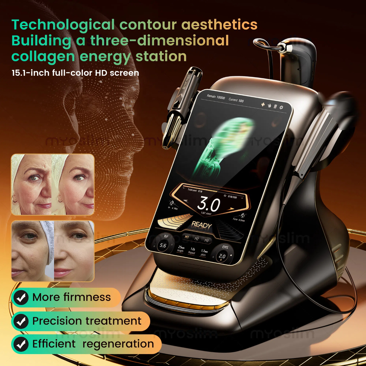 Top Sell Latest 25D High Intensity Focused 360MAX Face Lifting Skin Tightening Wrinkle Removal Body Slimming Anti-aging HIFU Machine