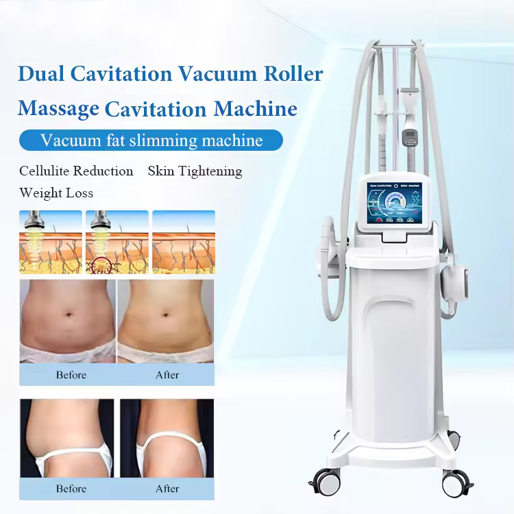 New 2026 Vela 4 In 1 Body Slimming Face Sculpting RF Vacuum Cavitation Effective Lipolysis Weight Loss Skin Elasticity Restoration Rolling Massage Vel