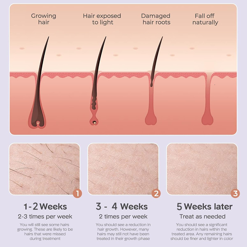 999999 Flashes IPL Laser For Women Home Use Devices Hair Removal Painless Electric Epilator Bikini Dropshipping