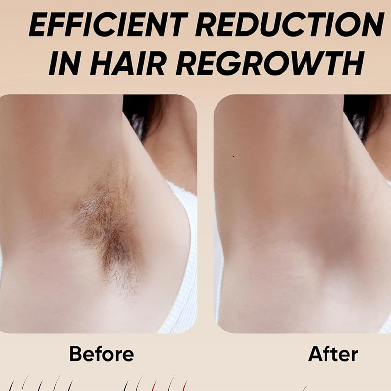 999999 Flashes IPL Laser For Women Home Use Devices Hair Removal Painless Electric Epilator Bikini Dropshipping