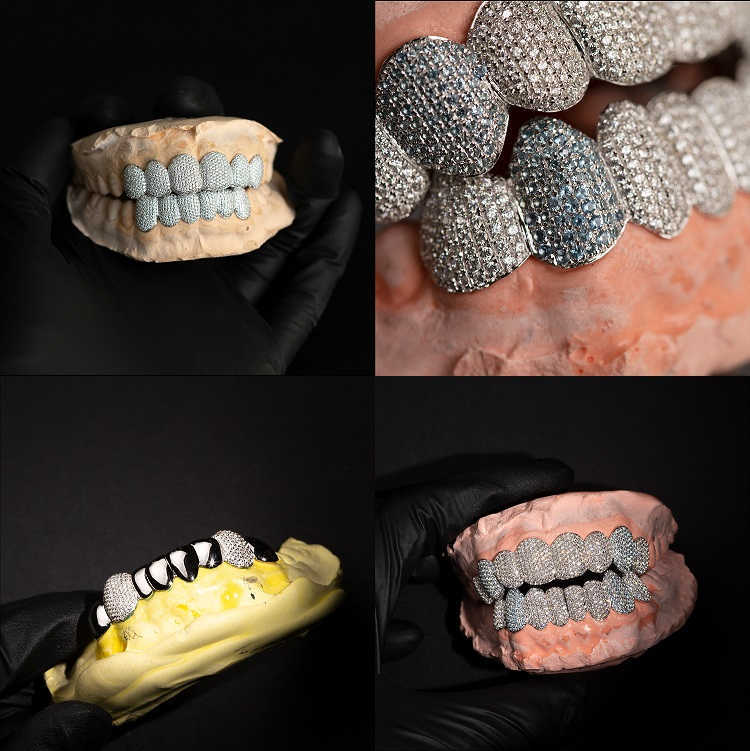 Custom Dental Grills Iced Out 925 Sterling Silver Real Gold Plated Jewelry Prong Setting Vvs Moissanite Diamonds Teeth Grillz