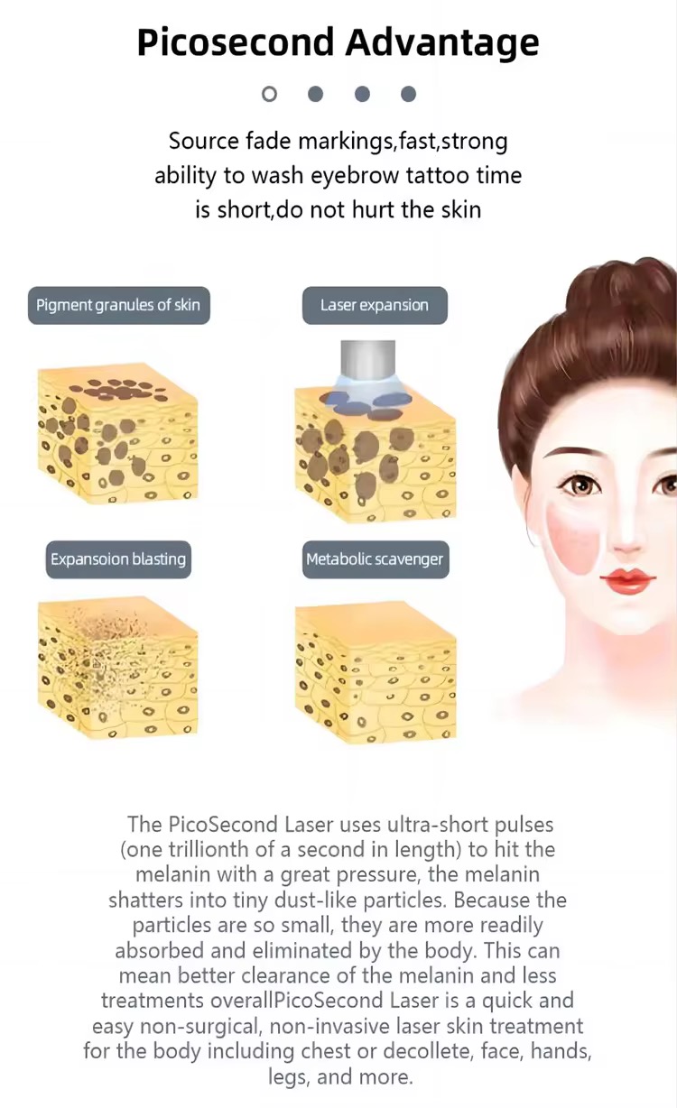 2025 Diode Laser Hair Removal Machine Depiladoral Portable Stable And Powerful Diode Laser Hair For Salon