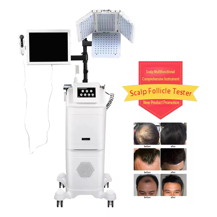 hair growth machine for hair loss / scalp treatment hair test scanner detector diagnostic analyzer analysis machine