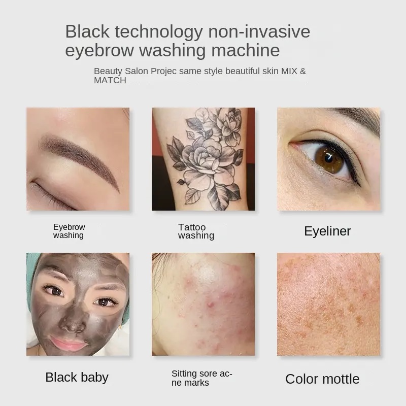 q switched nd-yag laser tattoo remove machine for freckle tag wart tattoo removal to picosecond laser tattoo remover machine