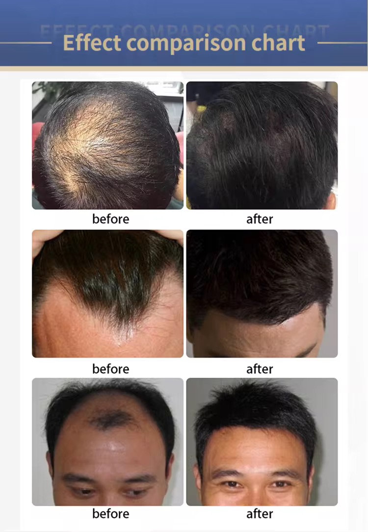 New 7 In 1 High Frequency Hair Follicle Detection Scalp Treatment Machine Hair Analyze Scalp Care Massage Hair Regrowth Device