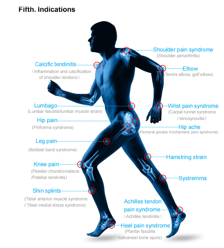 Medical Physiotherapy Focused Shockwave Therapy Machine EWT Focused Shock wave Pain Relief body treatment Tax Free to US/EU/UK