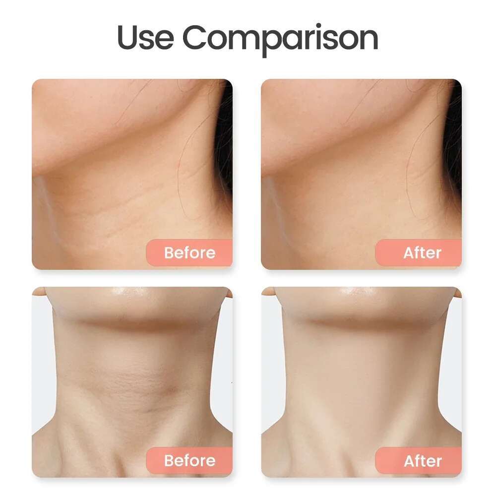 Electric Volcanic Facial Massager Natural Bian Heating Massage for Face Slim Lifting Skin Guasha Energy Stone Needle Warm