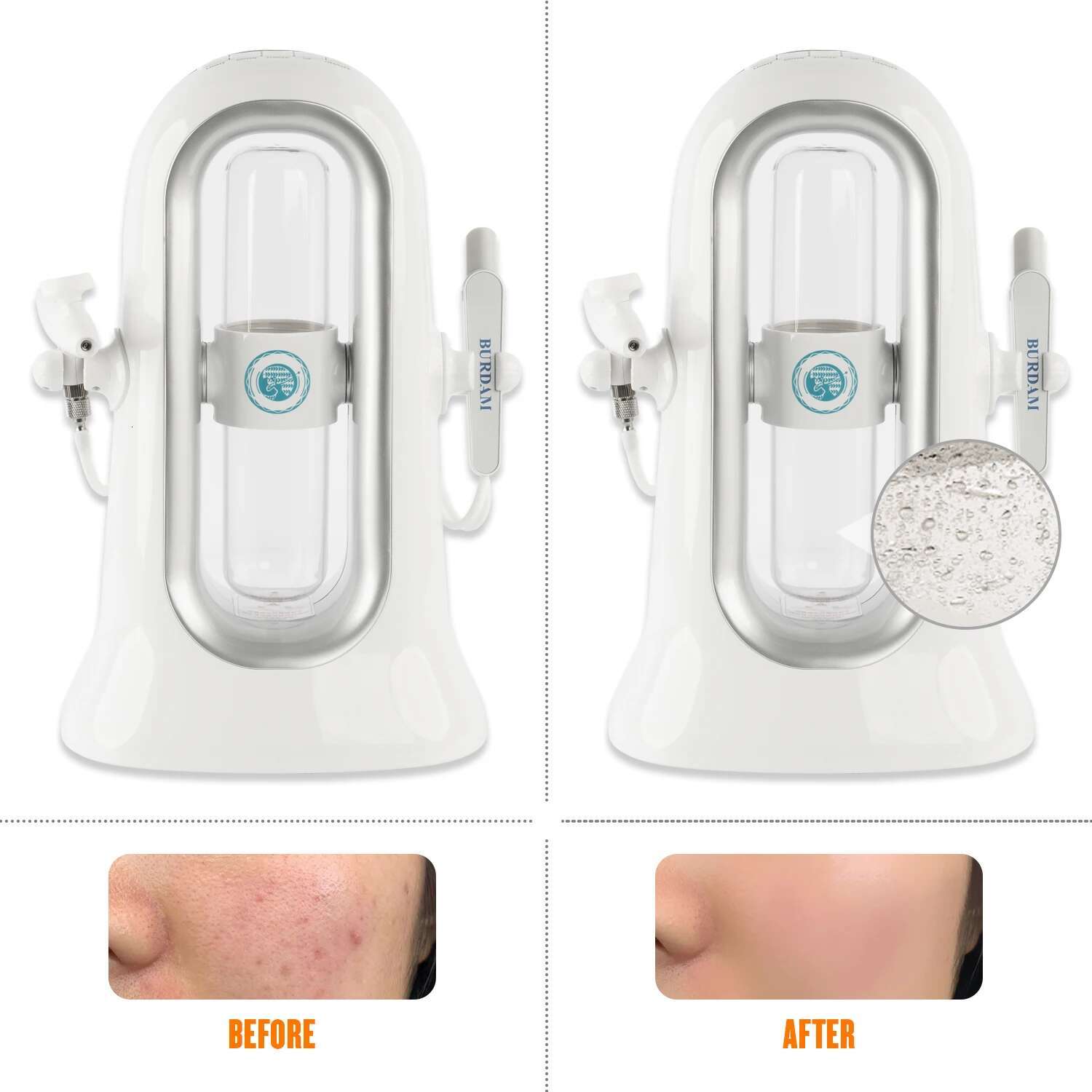 Home Use Hydra Suction Blackhead Cleansing Moisturizing Oxygen Injection Instrument Aqua Peeg SPA Dermabrasion Beauty hine