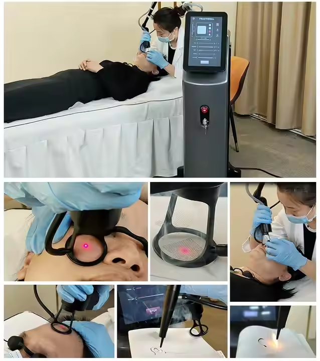 OEM Fractional Co2 Laser Machine Price Skin Resurfacing Rejuvenation Wrinkle Scars Freckles Removal Co2 Laser Fractional Beauty Salon Equipment