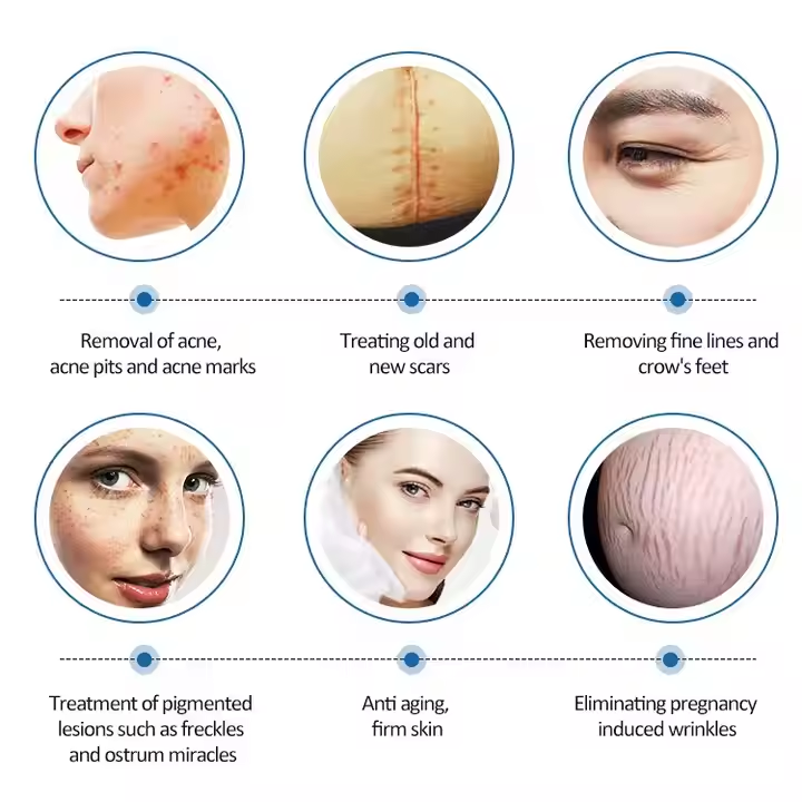 OEM Fractional Co2 Laser Machine Price Skin Resurfacing Rejuvenation Wrinkle Scars Freckles Removal Co2 Laser Fractional Beauty Salon Equipment