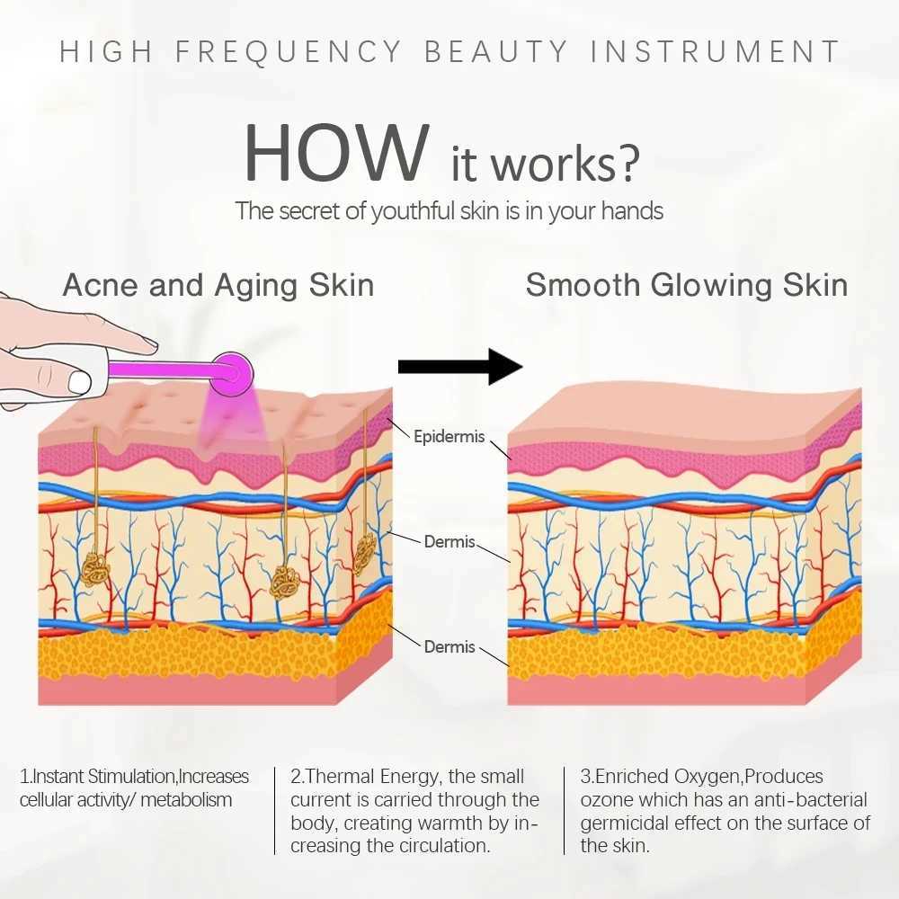 4pcs High Frequency Facial skin care wand device Acne Treatment Tool HF Hair Care Device Professional Kit with gift BoxXJ250113