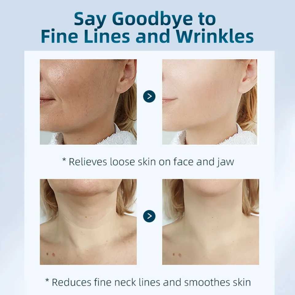 4 Color Neck Beauty Device EMS Face Lifting Machine Double Chin Remover LED Anti Wrinkle Skin Tightening Care Facial MassagerXJ250113