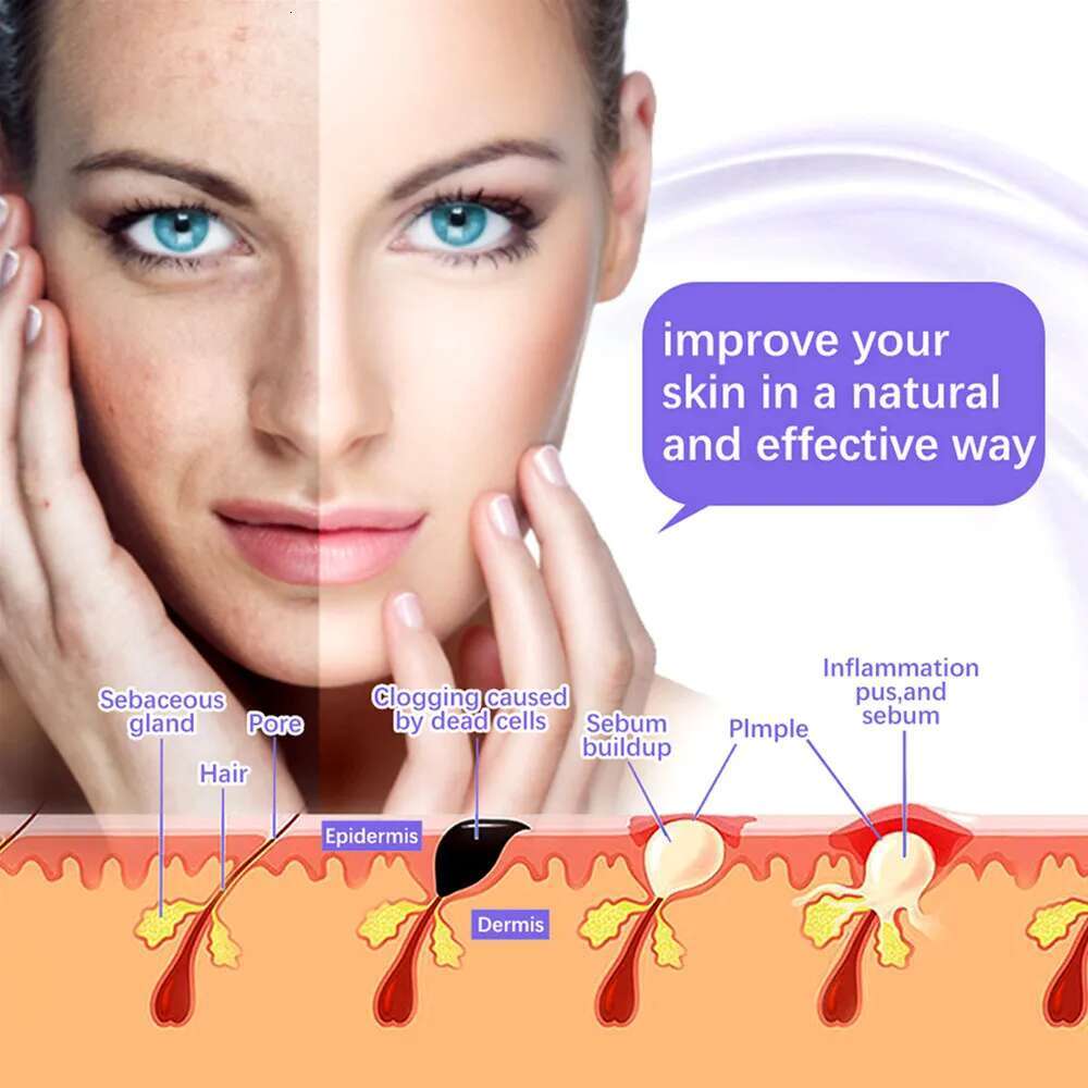 7 in 1 High Frequency Electro Therapy Wand Orange and Purple Glass Tube Remove Wrinkle Acne Spot Face Spa Skin Care Device