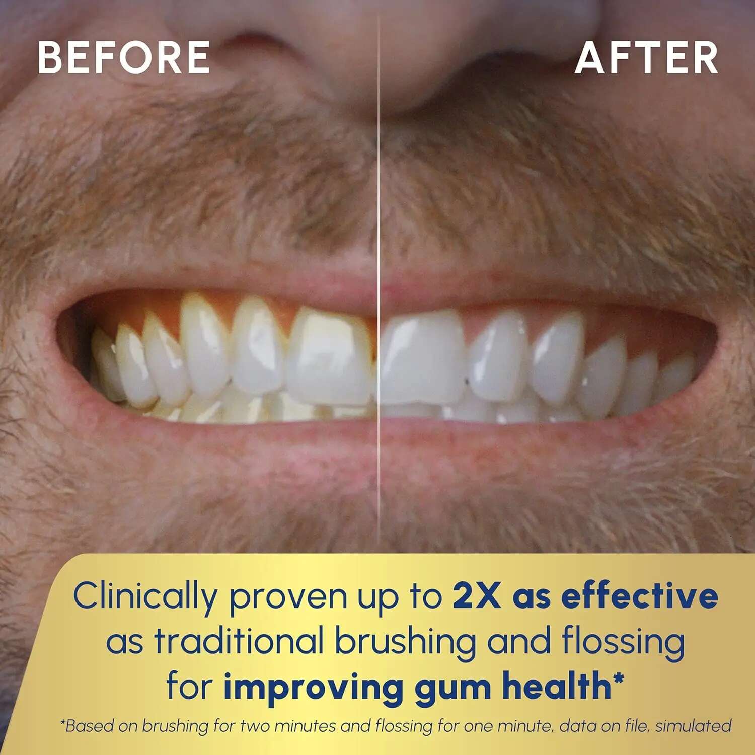 2.0 Professional ssing Toothbrush, Electric Toothbrush and Water sser Combo In One, White SF-04, Packaging May Vary