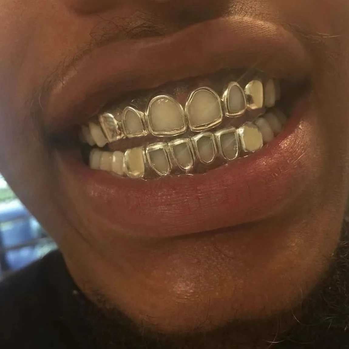 RACHELZ Hip Hop Hollow Teeth Grillz Braces Black Gold Color Glossy Tooth Caps For Women Men Jewelry Dental GrillsXJ250114