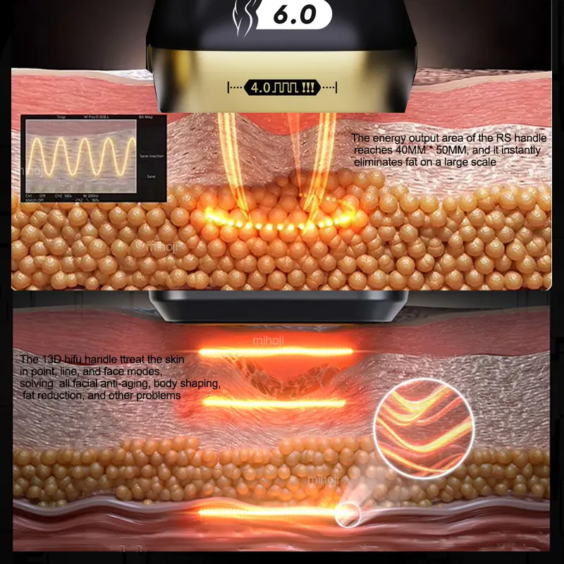 To Improve Sexual Life 22D 23D Hifu Machine Max 13D U-Ltherapy Machine Hifu Face Lifting Body Slimming Portable Hifu Wrinkle Remover Non-Invasive