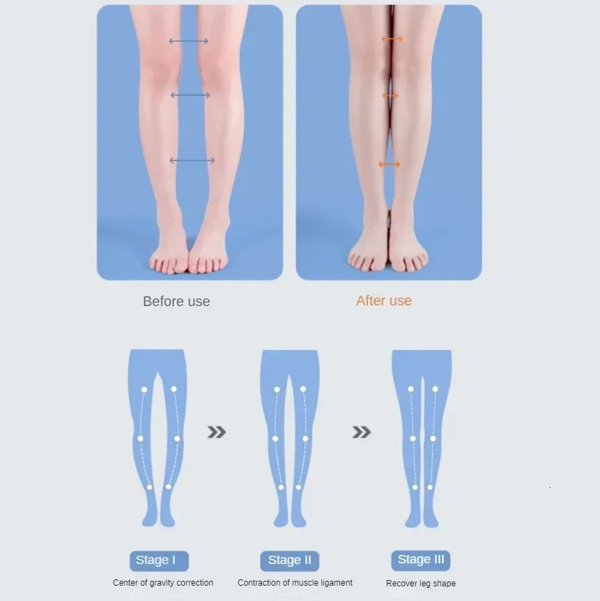 Ortic Insoles For Flat Feet Arch Support Orthopedic Shoes Sole PU Insoles For Feet Men Women O/X Leg Corrected Care Pad 250120