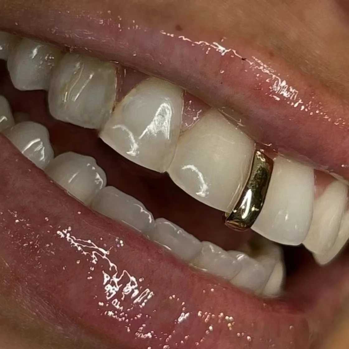 RACHELZ Hip Hop Single Glossy Vertical Bar Teeth Grillz Simple 14K Gold Plated Long Stick Tooth Caps For Women Men JewelryXJ250114