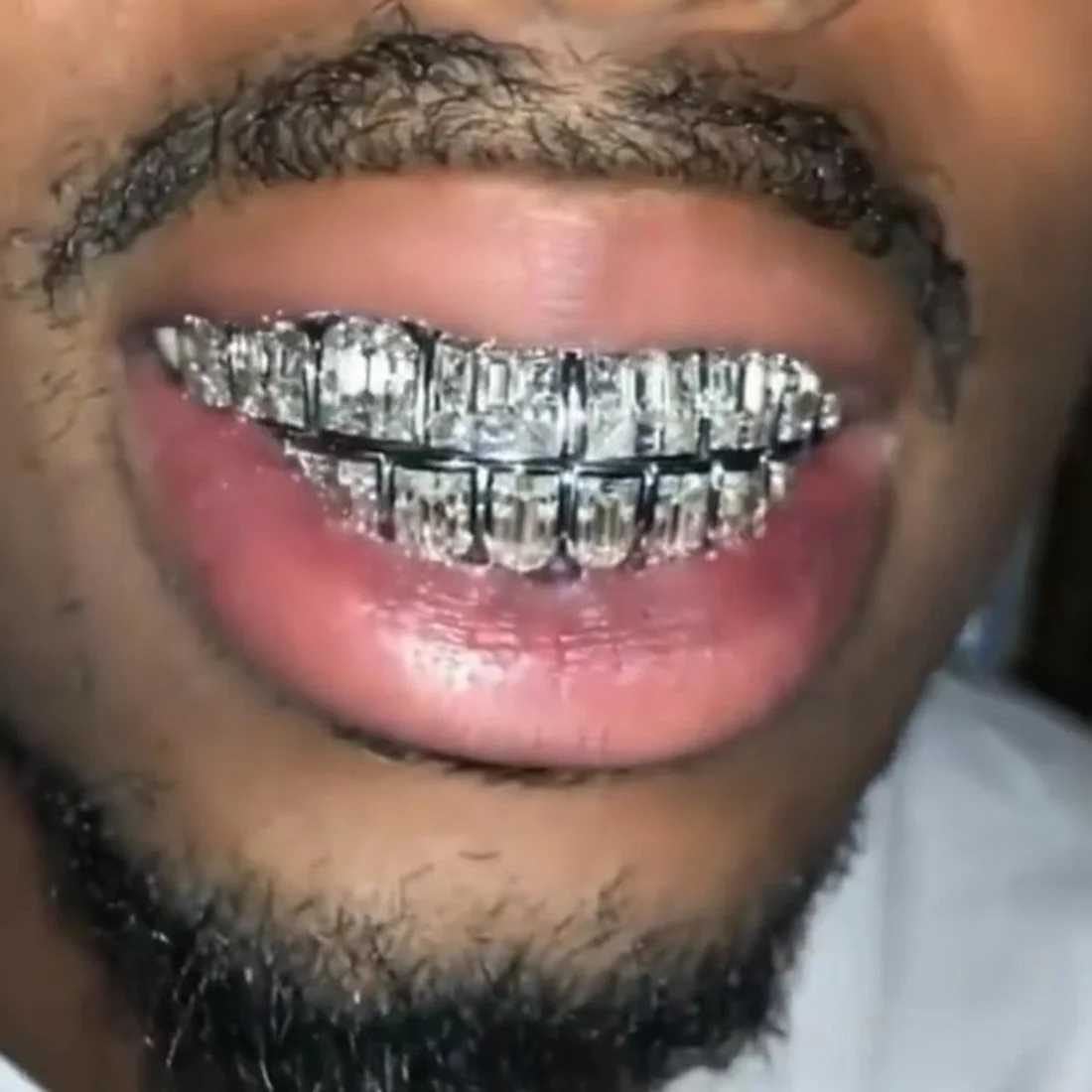 RACHELZ Sugar Cubic Zircon 8/8 Teeth Grillz Hip Hop Iced Out CZ Stone Dental Grills For Men Women Tooth Caps Decor JewelryXJ250114