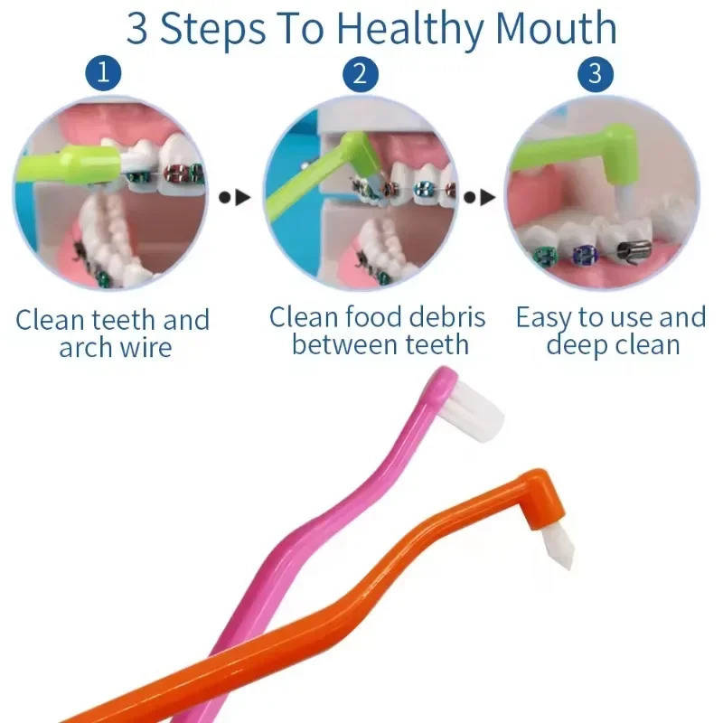 Orthodontic Interdental Brush DoubleBeam Soft Teeth Cleaning Toothbrush Oral Care Tool Small Head Hair Implant Adult 250115