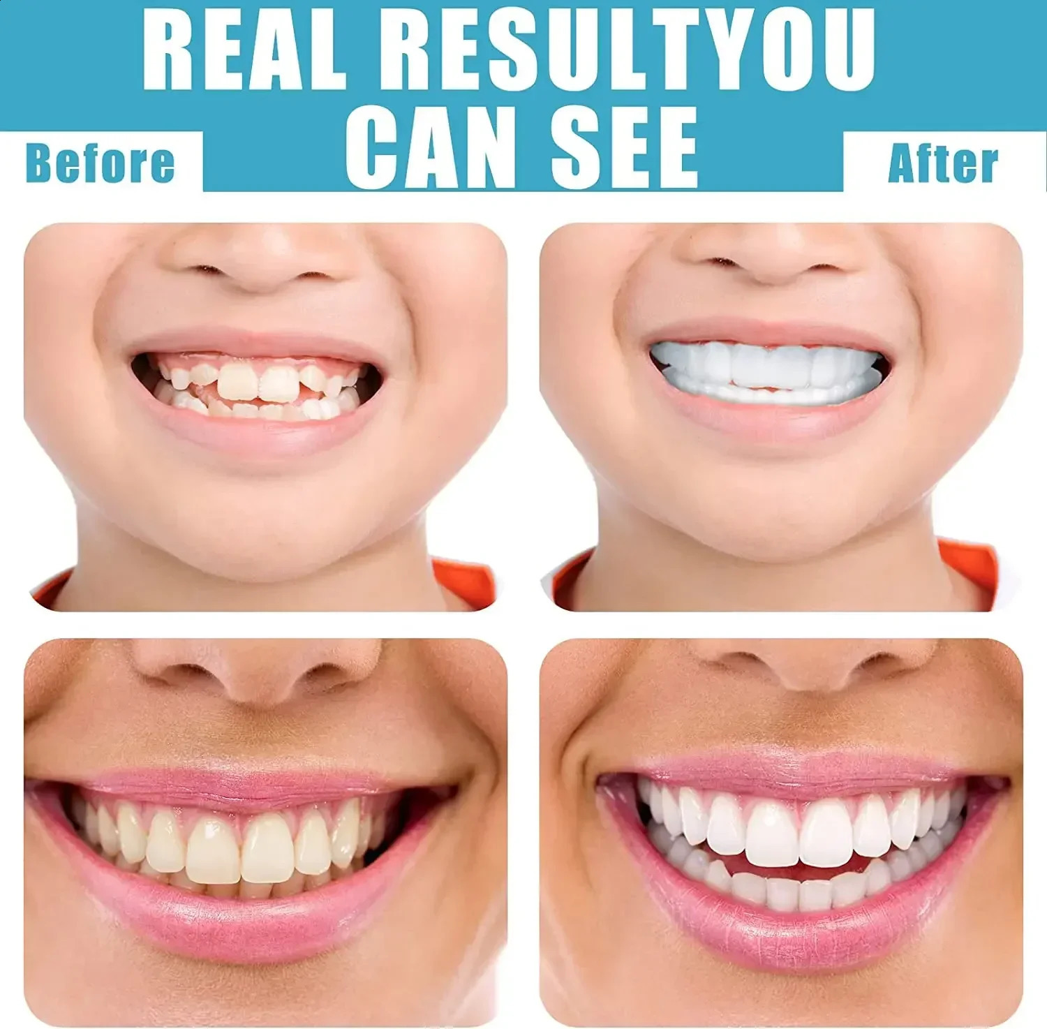 1pcs Veneers Teeth Cosmetic Teeth Temporary Smile Comfort Fit Flex Comfortable Top and Bottom Veneer Tooth 250122