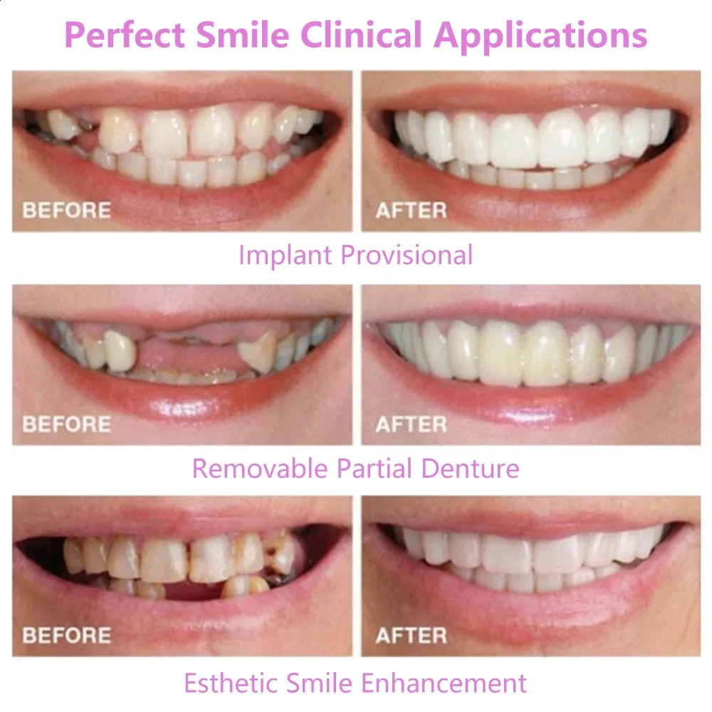 Upper Lower Teeth Cover Perfect Bright Veneers Comfort Fit Flex Dentures Braces Whitening Toy 250122