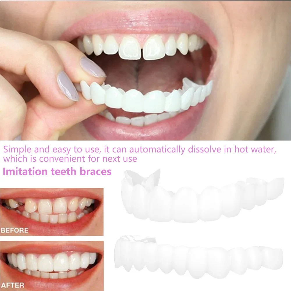 Upper Lower Teeth Cover Perfect Bright Veneers Comfort Fit Flex Dentures Braces Whitening Toy 250122