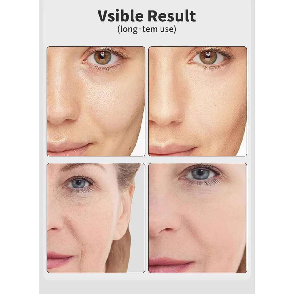 Neck Beauty Device with Gel Multi Color Massage Tightening Portable Ergonomic Face And Neck Beauty Massage Neck Beauty Massage