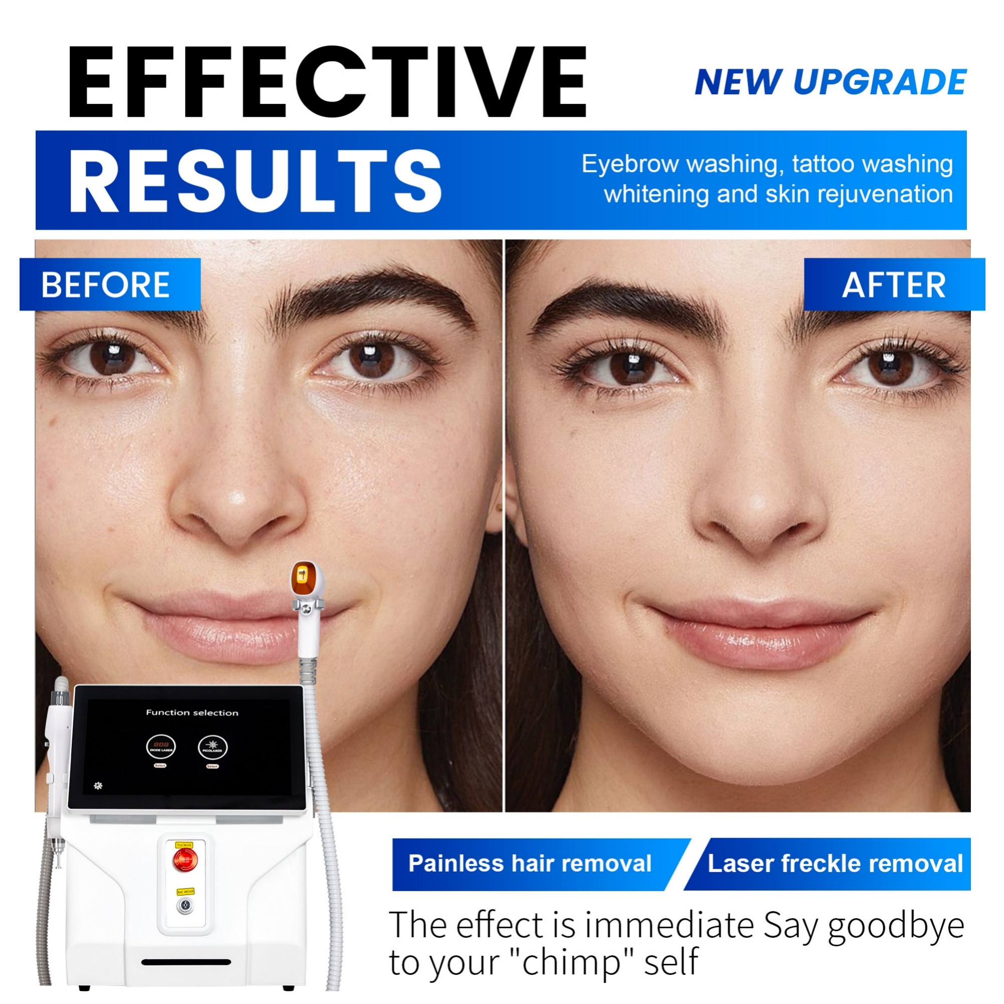 Diode Laser Hair Removal 2 in 1 Picosecond Machine for Permanent Hair Reduction, Tattoo Removal and Professional Skin Rejuvenation Treatments