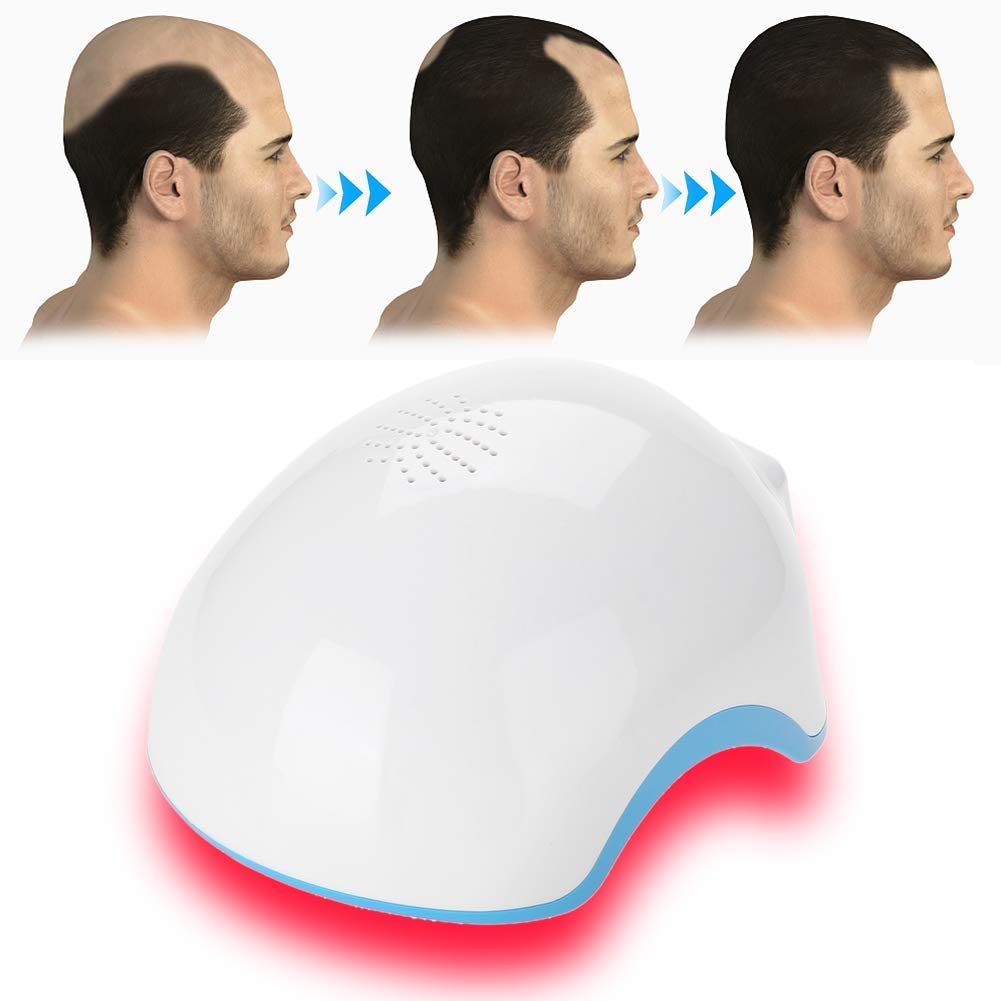Factory Direct Sale 272 Diodes Red Light Laser Hair Growth Helmet for Anti Hair Loss Laser Hair Regrowth Therapy