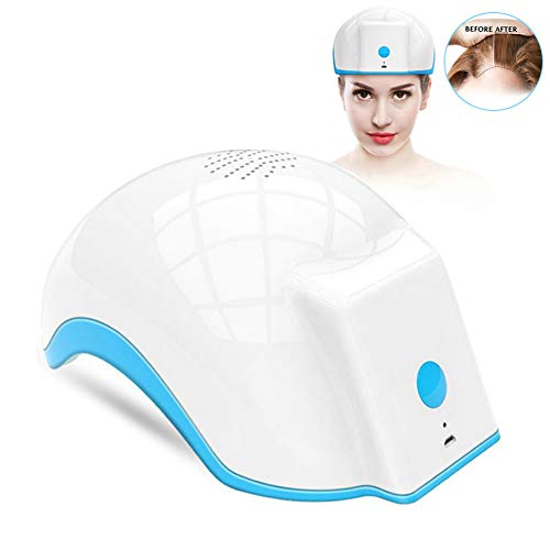 Factory Direct Sale 272 Diodes Red Light Laser Hair Growth Helmet for Anti Hair Loss Laser Hair Regrowth Therapy