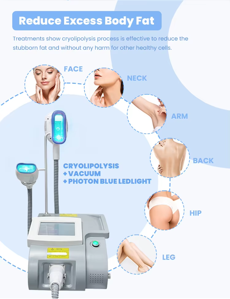Portable 360 Cryo Double Chin Removal Fat Freezing Slimming Cryolipolysis Body Slimming Cryotherapy Machine Body Sculpt Cellulite Remover